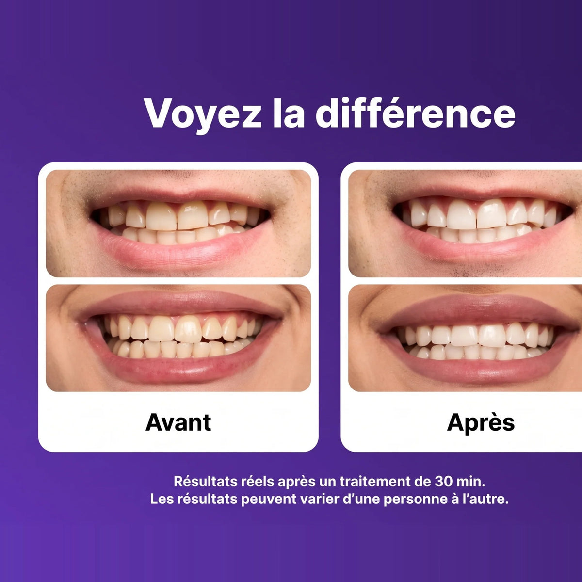 Bandes blanchissantes violettes